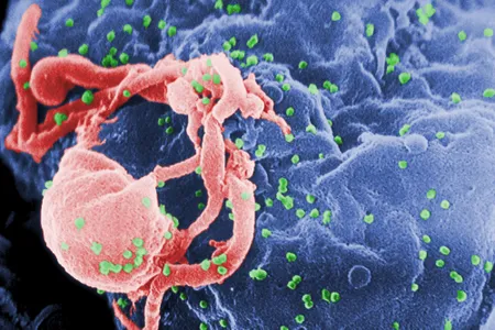 Scanning electron micrograph of HIV-1 (in green) budding from cultured lymphocyte (a type of white blood cell). Multiple round bumps on cell surface represent sites of assembly and budding of virions.