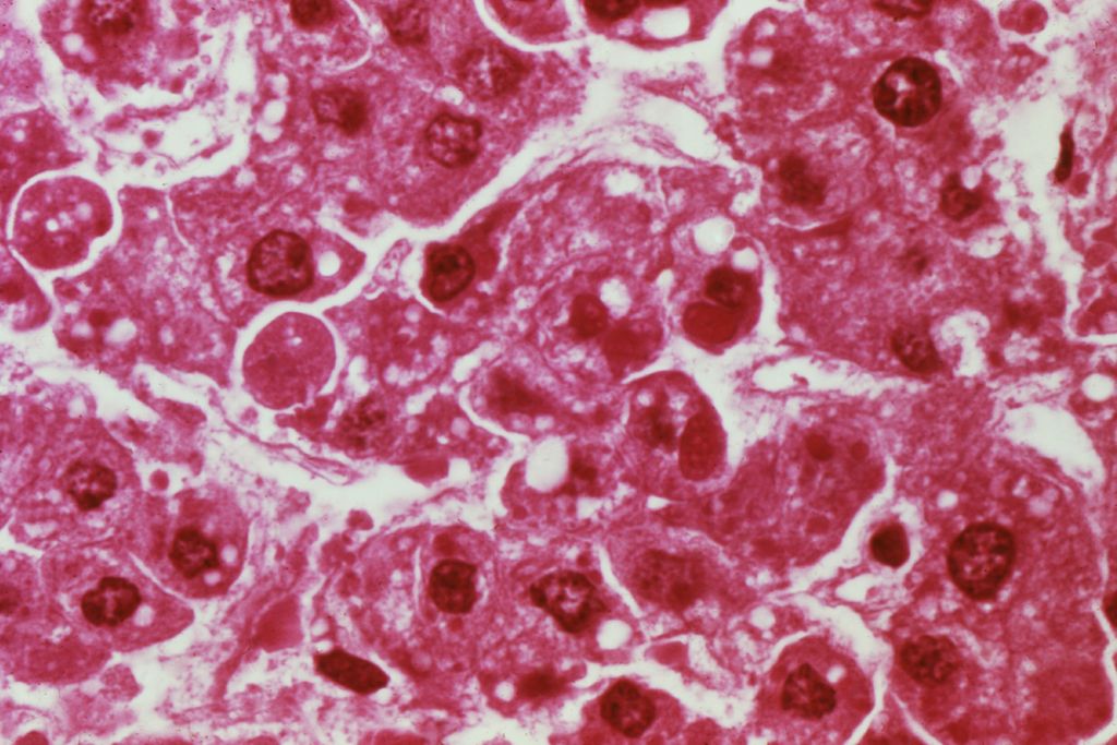 11_13_2014_ebola.jpg