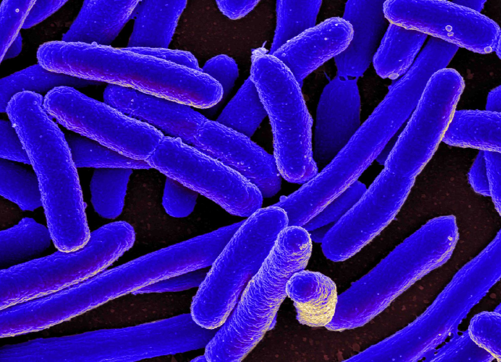 Scientists Used A.I. to Redesign a Microbe's Machinery to Function Without a Key Ingredient of Life