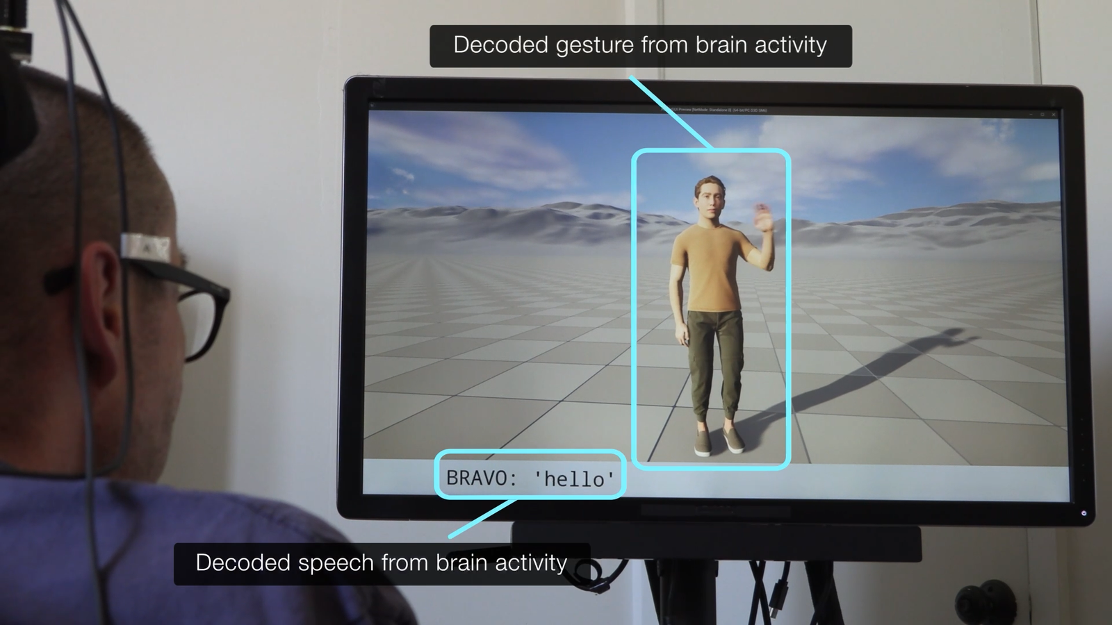 This Brain Implant Allows People With Paralysis to Speak and Gesture at the Same Time Via a Mind-Controlled Virtual Avatar