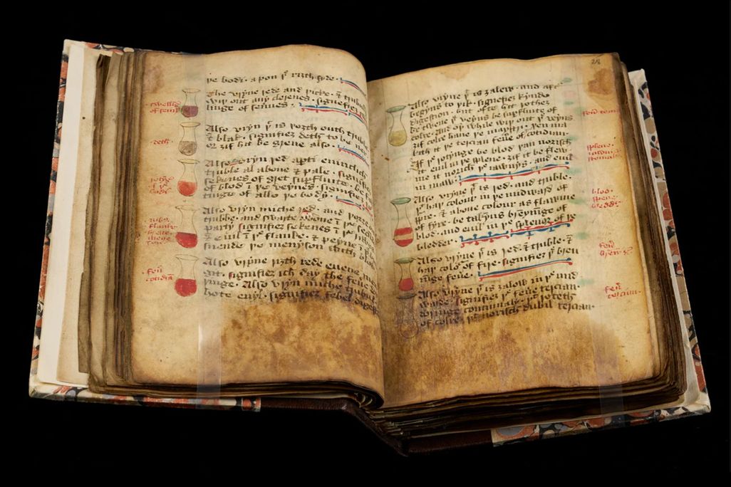 This 15th-century medical manuscript shows different colors of urine alongside the ailments they signify.