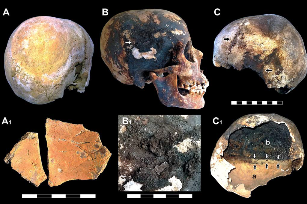Exploded Skulls