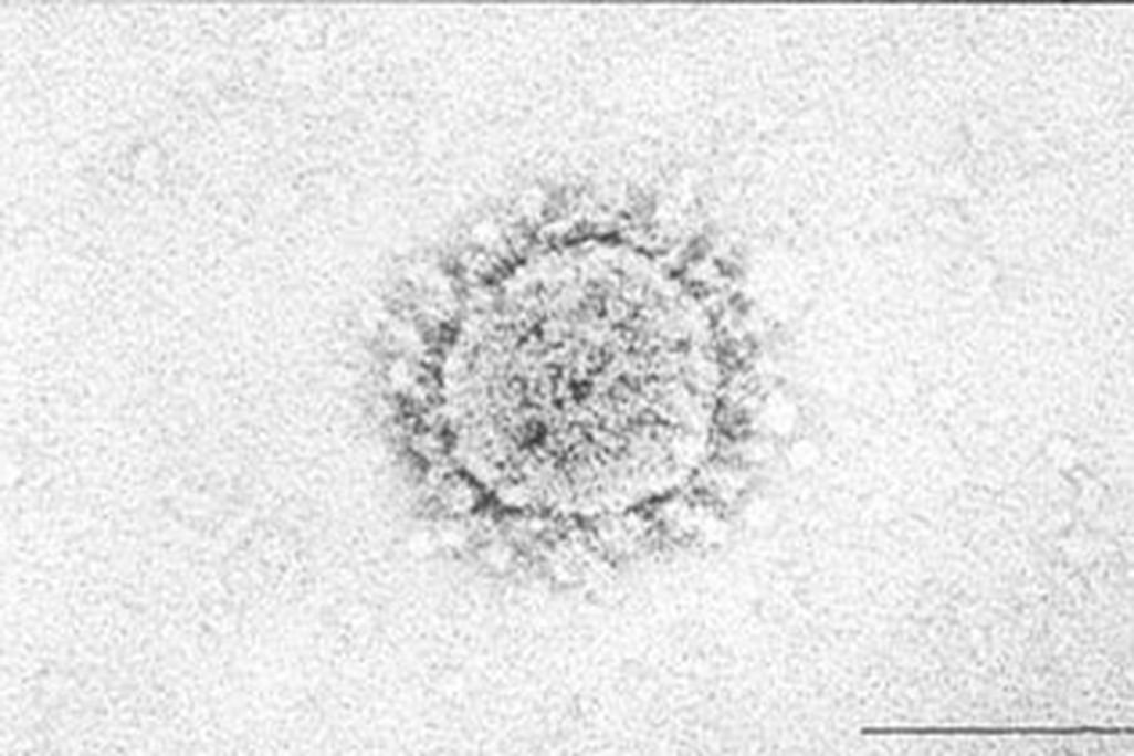 presence_virus.jpg