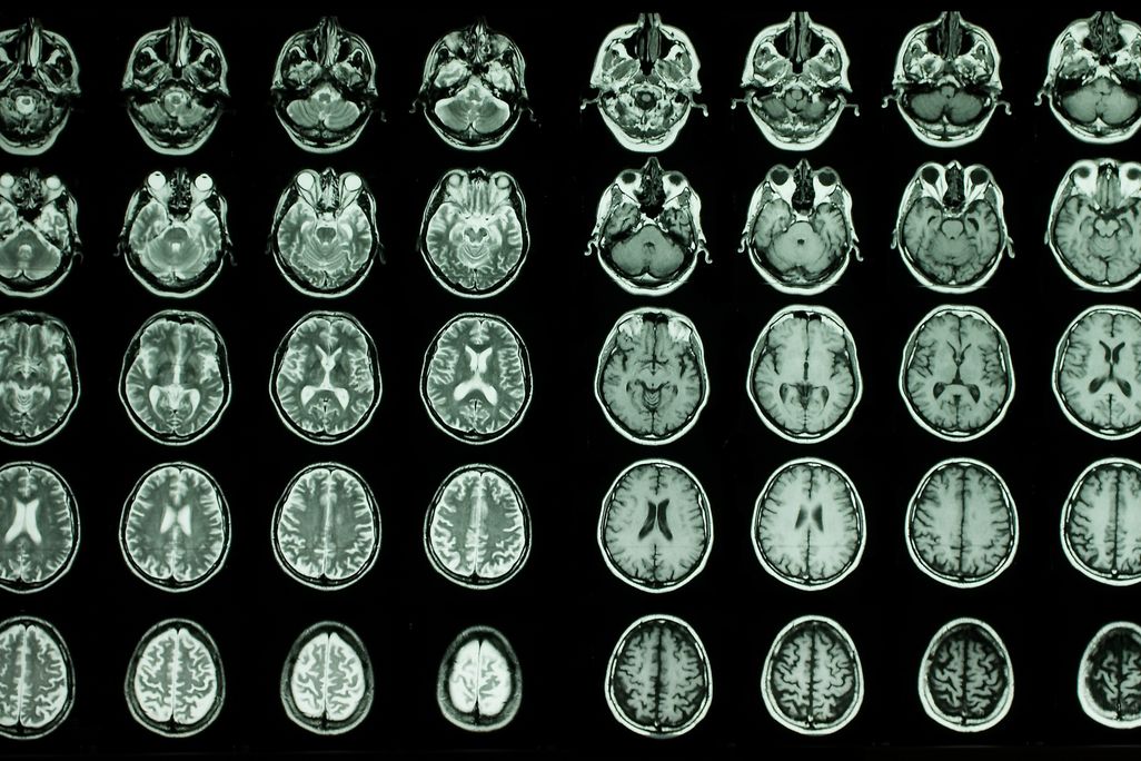 many brain scans in rows and columns