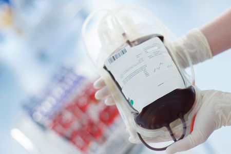Although scientific discoveries about blood started happening in the seventeeth century, blood transfusions are (mostly) a twentieth-century thing.