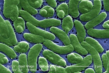 A digitally colorized view of&nbsp;Vibrio vulnificus&nbsp;bacteria under a scanning electron microscope