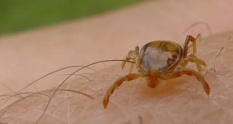 20131029070203tick-bite.jpg