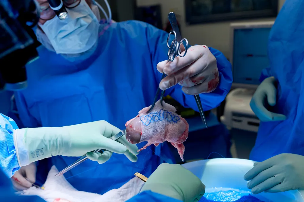 Doctor in blue scrubs holding up pig kidney