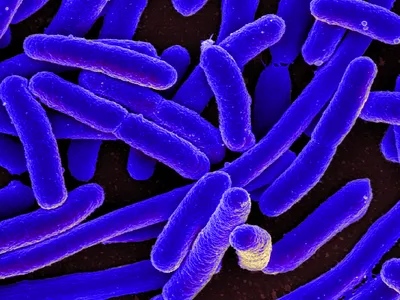 While many strains of E. coli&nbsp;are harmless, some can cause illness.