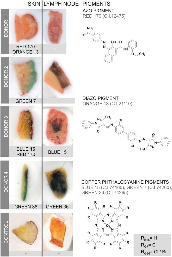 Tattoo ink contaminants can end up in lymph nodes, study finds