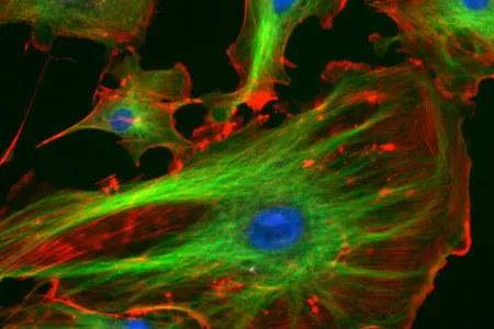 Endothelial cells under the microscope