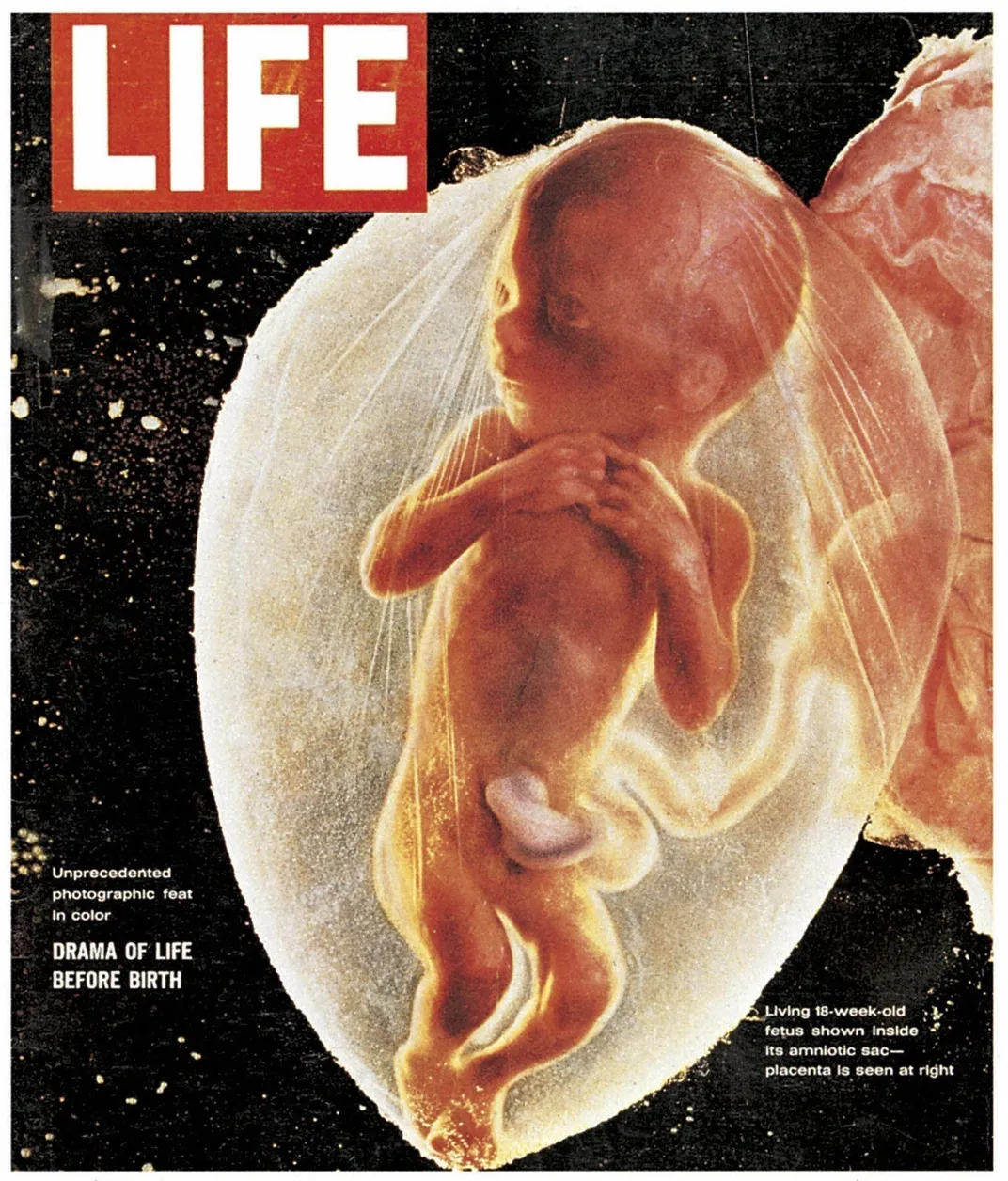 Life magazine fetus cover