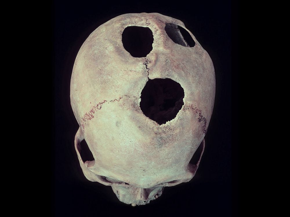 Cuzco-Skull.jpg