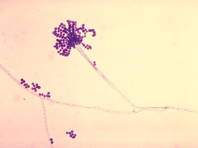 A microscopic image of Aspergillus fumigatus, an infectious fungus that can harm people with compromised immune systems.