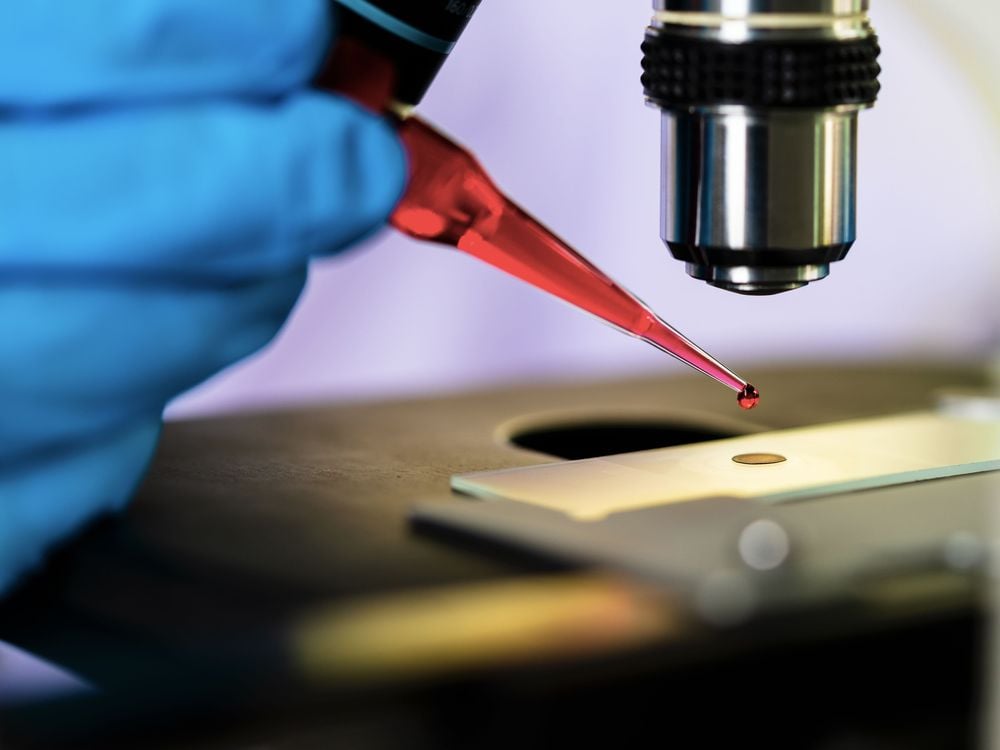 image of hand and pipette tip dripping blood into a dish under a microscope