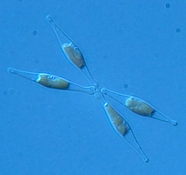 iron-fed diatoms