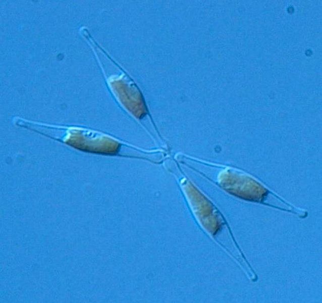 iron-fed diatoms