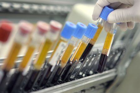 The blood test screens for over 50 types of cancer, some of which can not be screened for currently.