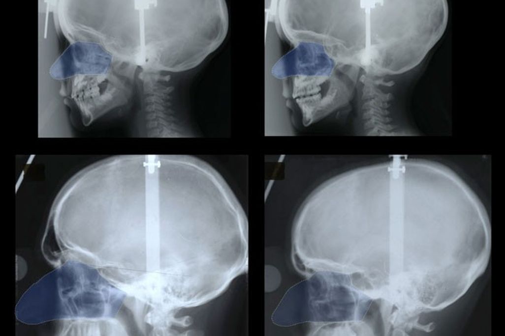20131120085025nose.jpg