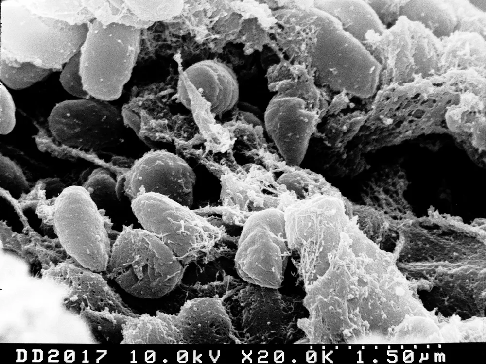 An image captured by a scanning electron microscope of Yersinia pestis bacteria, which causes the bubonic plague.
