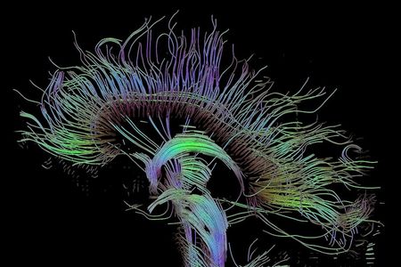 Visualization of a diffusion tensor imaging (DTI) measurement of a human brain. Depicted are reconstructed fiber tracts that run through the mid-sagittal plane.