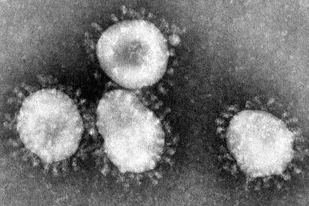 Coronaviruses, like the newly identified Wuhan coronavirus, are so named for their halo- or crown-like appearance.