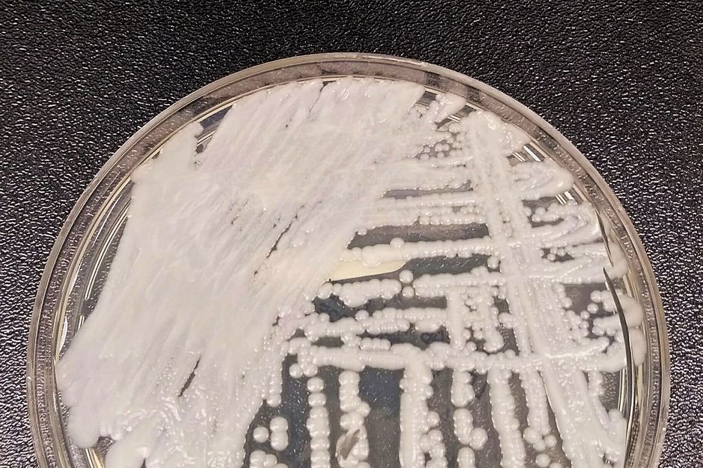 An upclose photo of a petri dish innoculated with <i>C. auris<i/>