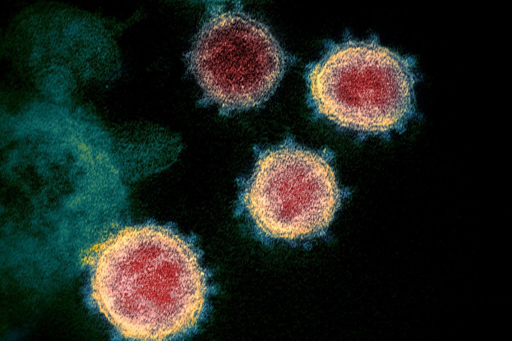 An electron microscope image of of SARS-CoV-2