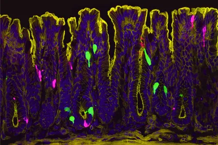 Estrogen may cause certain colon cells, shown in green in this microscope image, to release a hormone called peptide YY. This, in turn, causes a different type of colon cell, colored magenta, to pump out the chemical messenger serotonin, which activates pain-sensing nerve fibers.