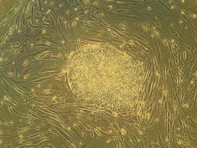 Human embryonic stem cells in cell culture