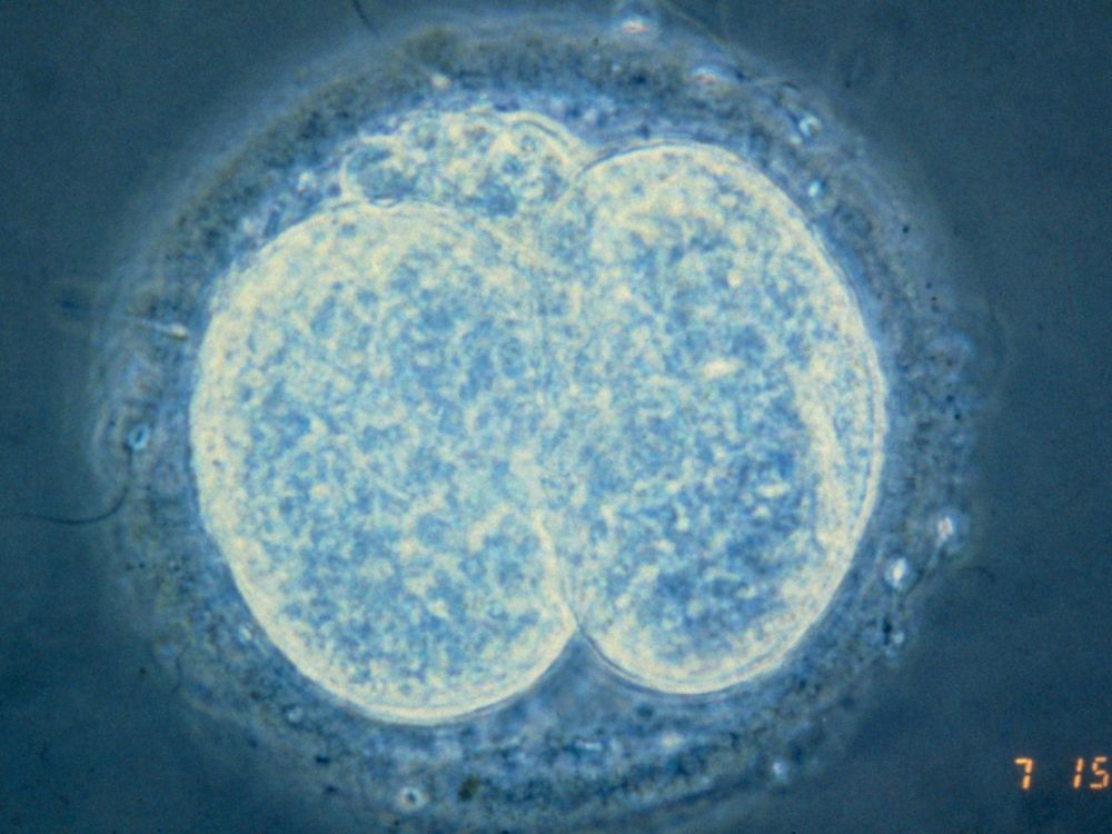 Human embryo