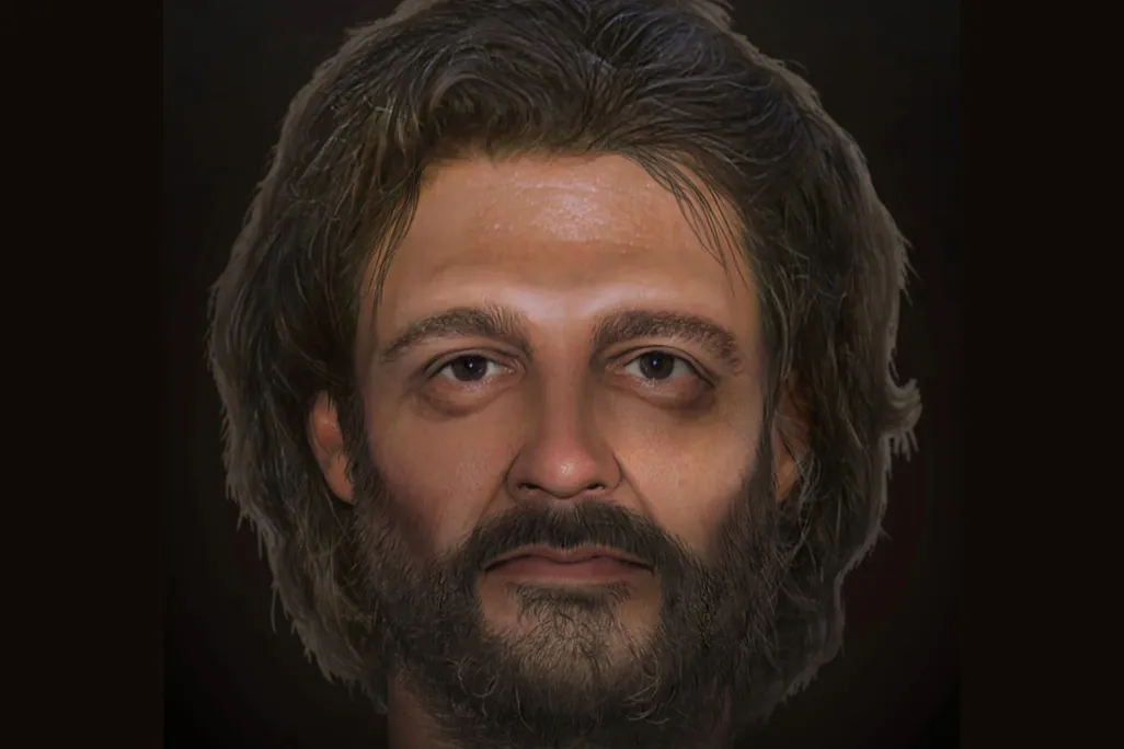 Facial Reconstruction