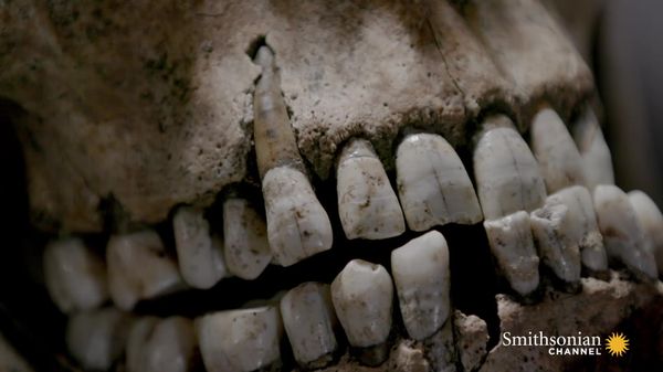 Preview thumbnail for Gladiator Teeth Reveal Signs of Infant Malnourishment