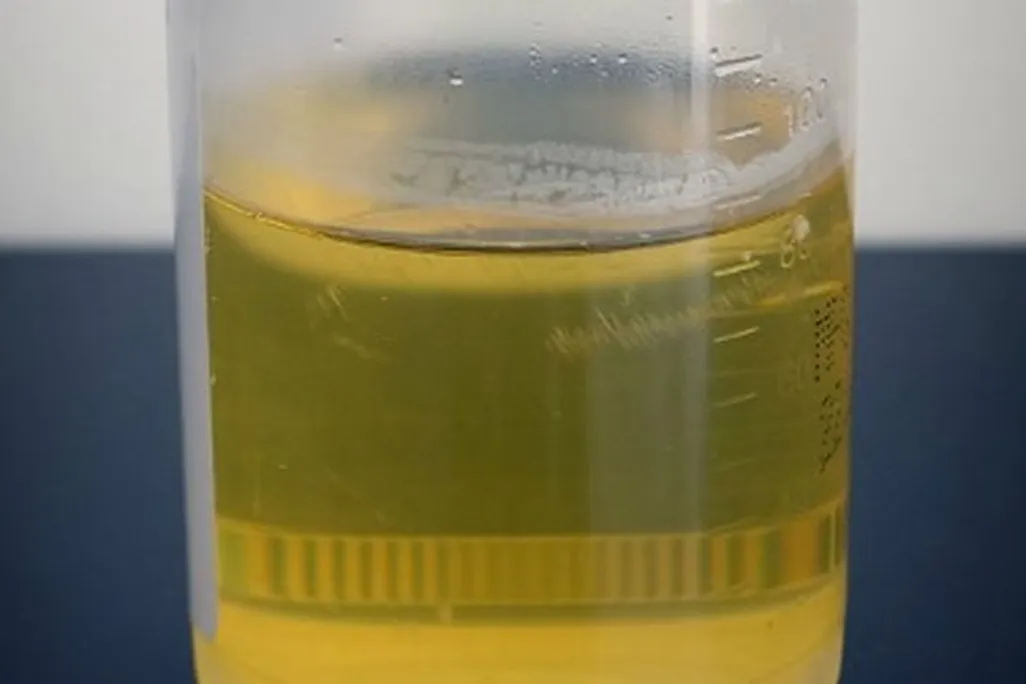 urine