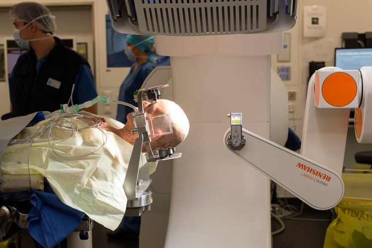 deep brain stimulation