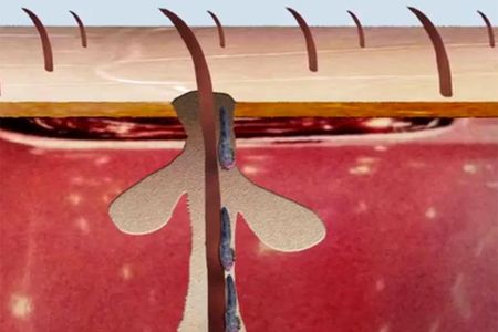 Two species of mites make their home in the hair follicles on your face. 