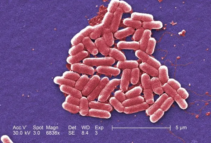 E. coli bacteria shown under a microscope at 6836X magnification