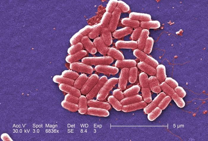 E. coli bacteria shown under a microscope at 6836X magnification