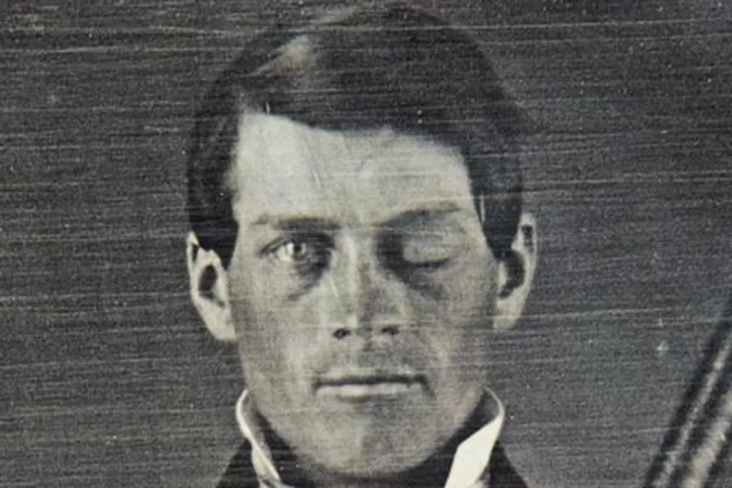 Phineas Gage