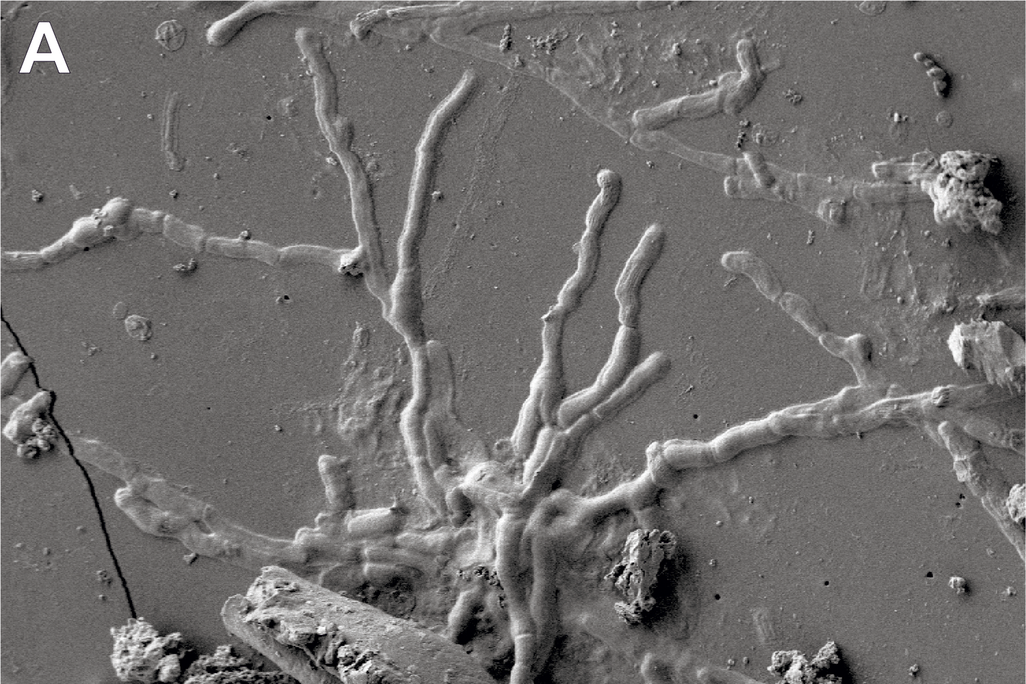 Two images of grey backgrounds with webs of small lines that look like vessels or roots of a plant; these are brain cells, which are thing elongated cells