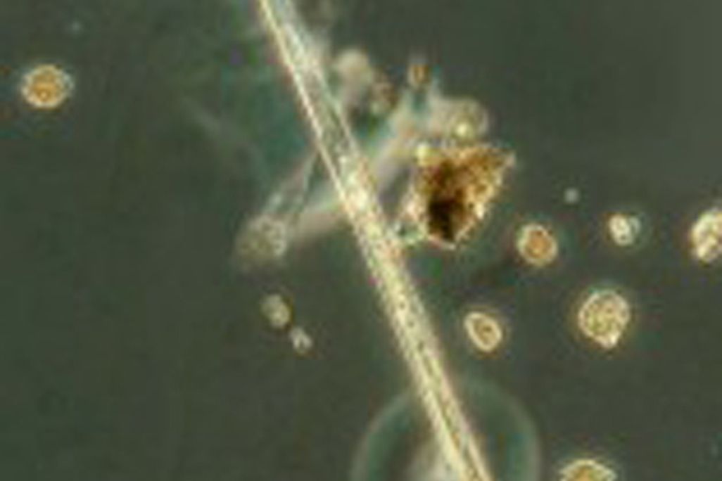Amphisolenia-hires-11-157x300.jpg