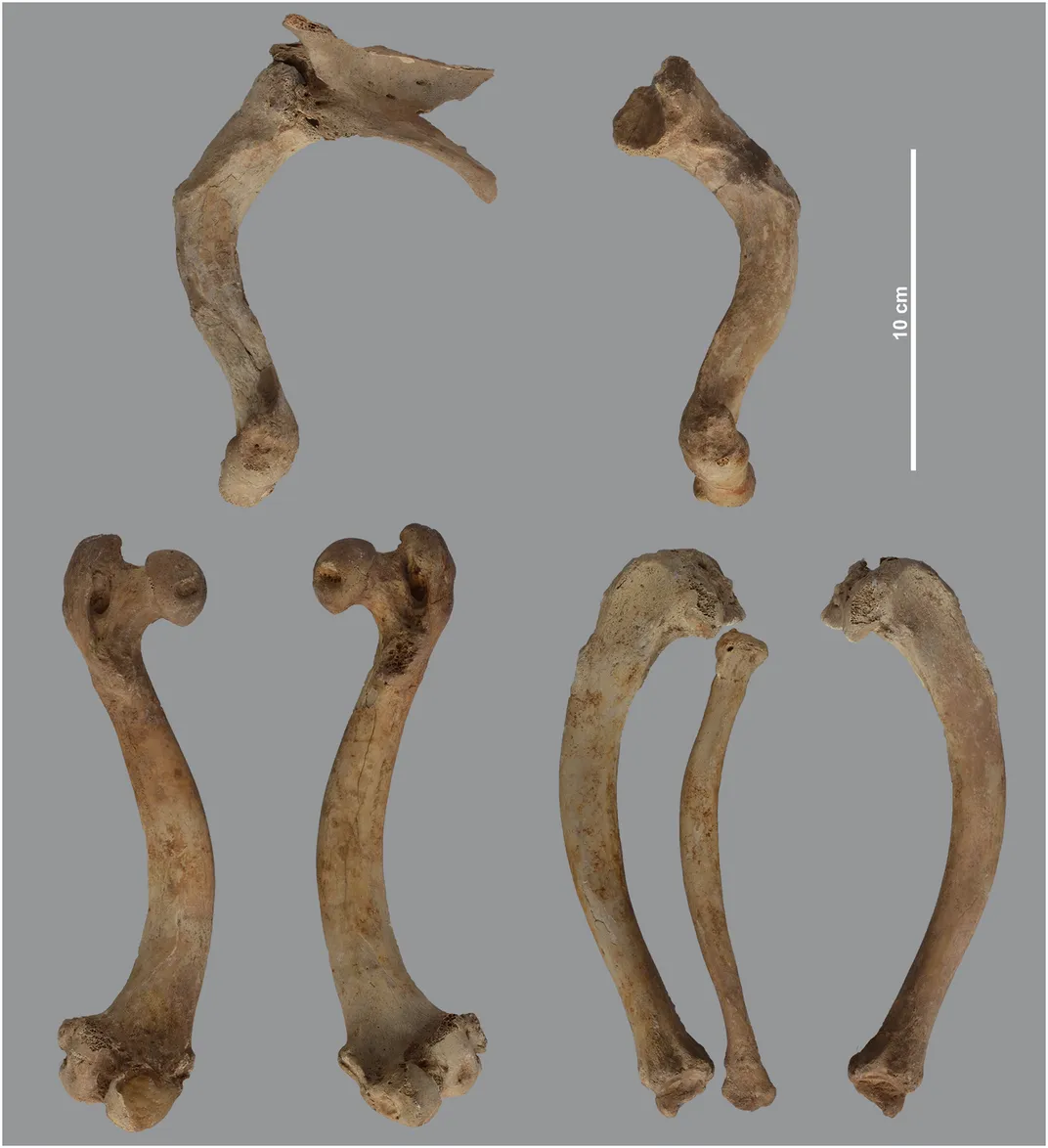 Overview of the long bones