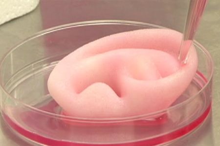 This artificial ear was made on a 3D printer.