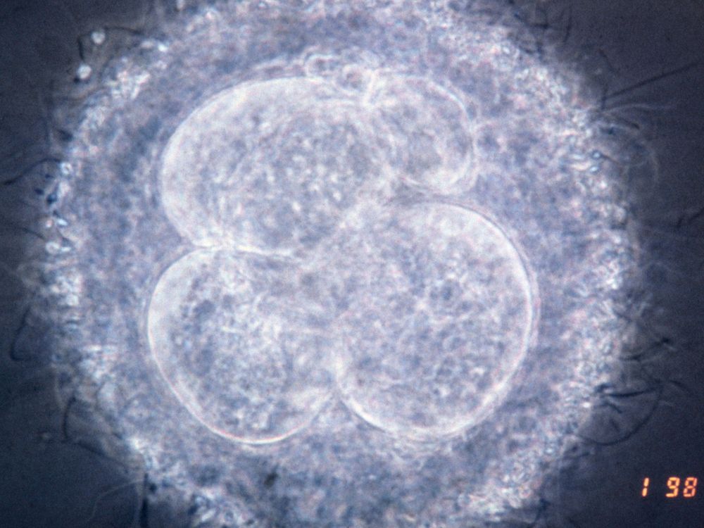 British Scientists Get Permission to Genetically Modify Human Embryos ...