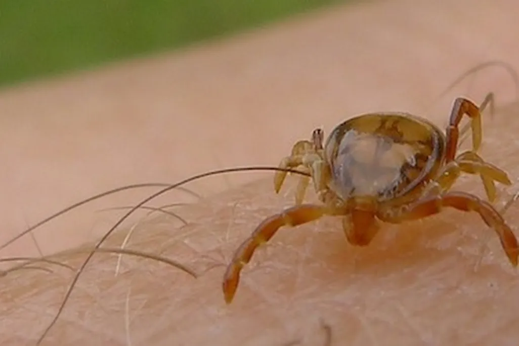 20131029070203tick-bite.jpg