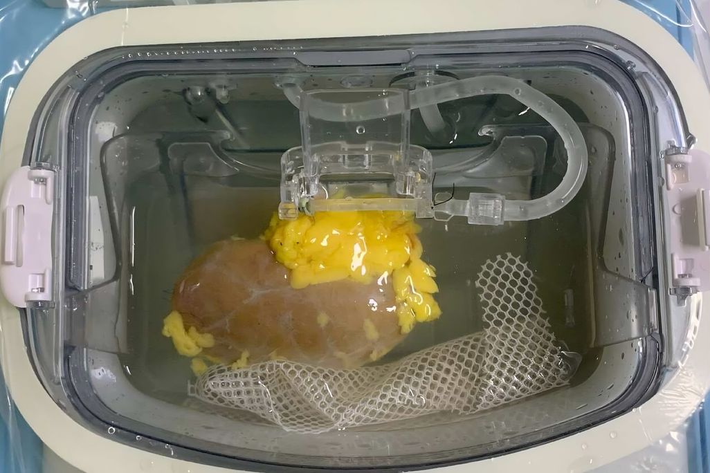 Organ inside a medical device