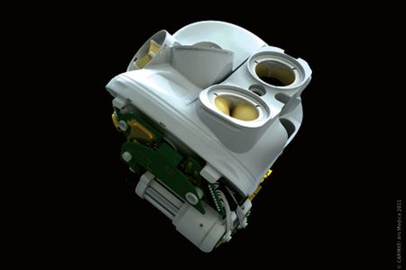 The Carmat artificial heart features sensors to monitor and adjust blood flow depending on the body's demands.
