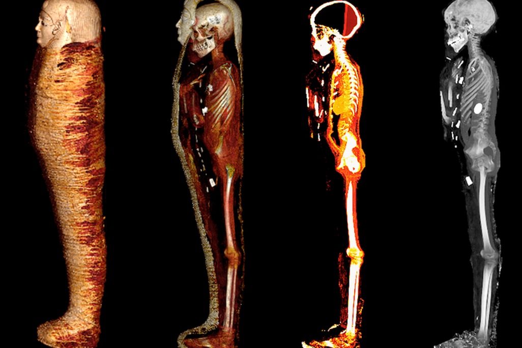 Four CT scans of a mummified body