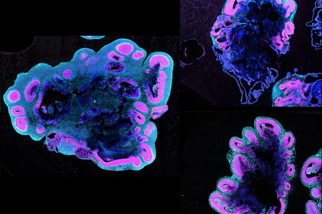 brain organoids