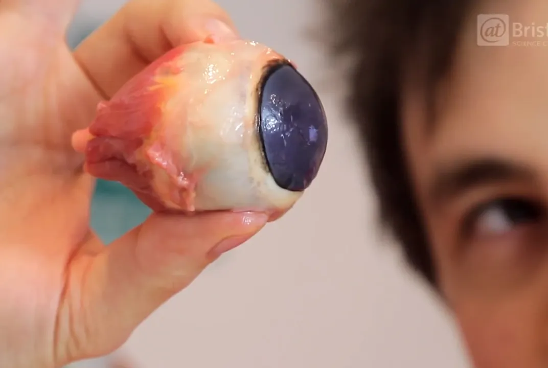 If You Like Gore, You'll Like Watching This Eyeball Get Dissected